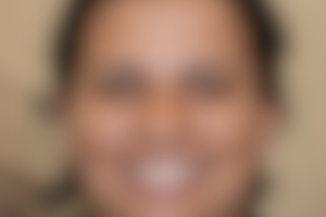 Nora, 54
